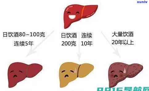 冰岛古树熟茶价格、口感特色及功效解析