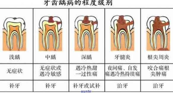 发黑翡翠原石图片，探究神秘的黑色翡翠原石：惊艳绝伦的图片展示