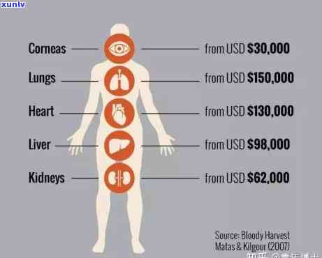 人体器官的价钱，「人体器官黑市交易」：揭示令人震惊的非法器官交易 *** 