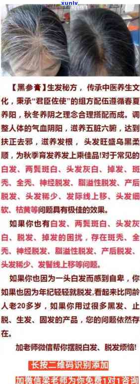 乌根益生茶真能治白发病吗，探究真相：乌根益生茶能否有效治疗白发？