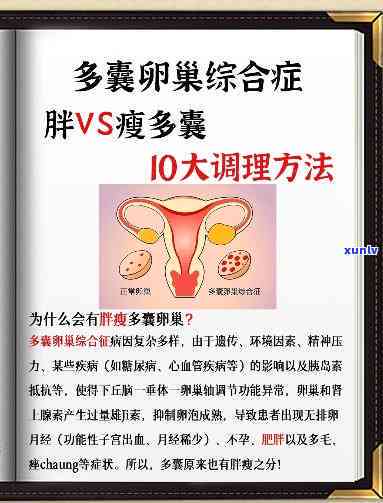 多囊适合喝什么茶调理？胖多囊如何快速减肥？调理方案分享