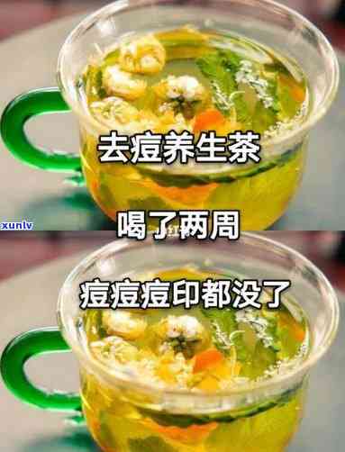 茶叶水可以治痘痘吗，茶叶水真的能治疗痘痘吗？科学解析