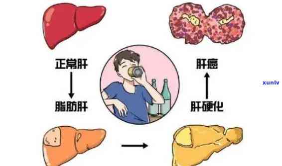 平安信用卡逾期：政策解读、起诉风险评估及逾期天数界定，如何处理？