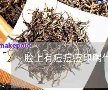 喝茶叶会留痘印吗？探讨其对皮肤的影响