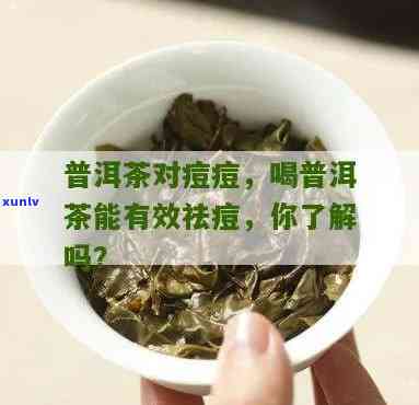 喝茶叶对痘痘有好处吗，喝茶叶能改善痘痘问题吗？探讨其功效与作用