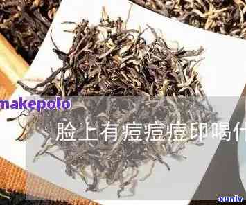 喝茶叶对痘痘有好处吗，喝茶叶能改善痘痘问题吗？探讨其功效与作用