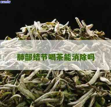 肺结节能喝茶叶茶吗-肺结节能喝茶叶茶吗女性