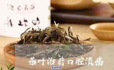 治疗口腔溃疡的茶叶-治疗口腔溃疡的茶叶有哪些