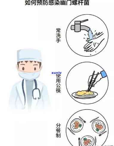 幽门螺杆菌四联标准吃法，详解幽门螺杆菌四联标准吃法：如何正确服用？