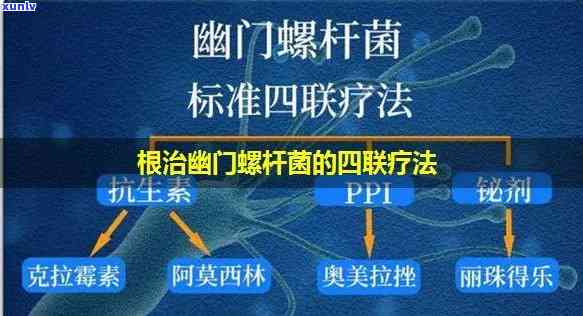 幽门螺杆菌四联标准吃法，详解幽门螺杆菌四联标准吃法：如何正确服用？