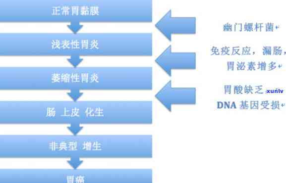 治疗幽门螺杆菌茶饮的有效配方与使用 *** 