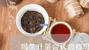 长痘可以喝茶叶茶吗-长痘可以喝茶叶茶吗女生