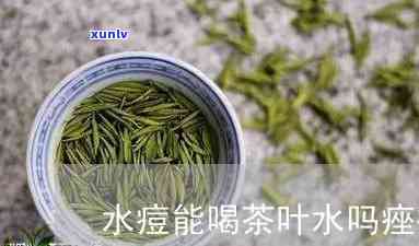 水痘可以喝茶叶水吗宝宝，宝宝出水痘期间是否适合饮用茶叶水？