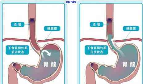 胃不好能喝红茶叶吗，胃部不适？红茶叶是否适合饮用？