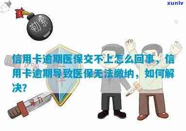 信用卡逾期医保不能报销-信用卡逾期医保不能报销吗