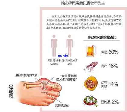 探究生普对痛风患者是否具有益处