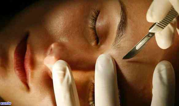 普洱地区哪家医疗机构的眼部整形手术更受欢迎：打造自然双眼皮