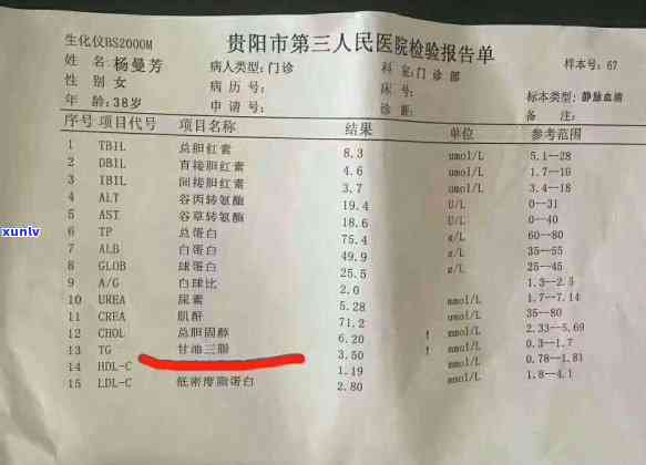 探究金木浴疗：养生还是治疗？它的优点、效果及适用人群全解析