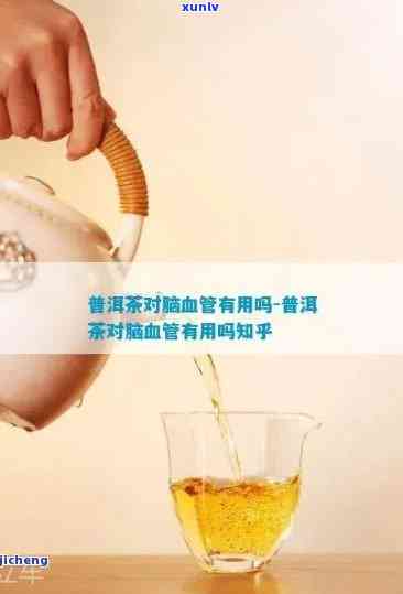 普洱茶的健益处：预防和改善脑血管疾病的新视角