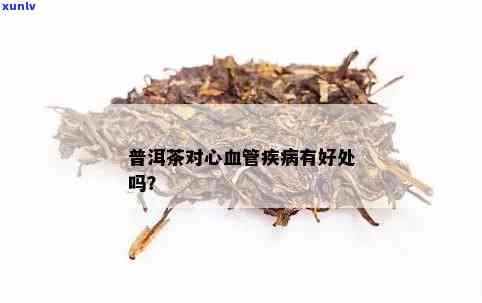 医生妙手：普洱茶是否为心血管病人的良方？