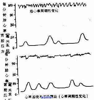 新 喝完普洱茶后的心跳波动及其可能原因探究