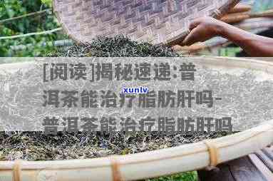 脂肪肝患者喝普洱茶的妙手医术：医生详解是否适宜饮用