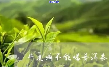 头皮癣能喝普洱茶吗