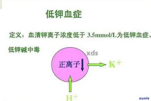 低血钾患者的饮茶指南：是否可以喝浓茶以提高血钾水平？