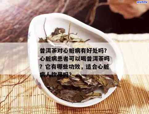 心梗喝普洱茶好吗？能喝吗？有效果吗？