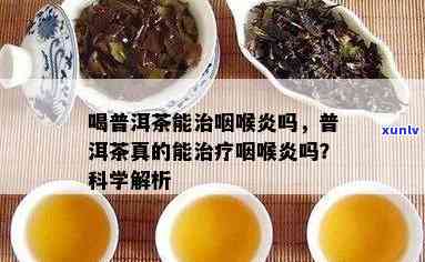 普洱茶能治咽喉炎吗？怎么喝？请提供相关信息。