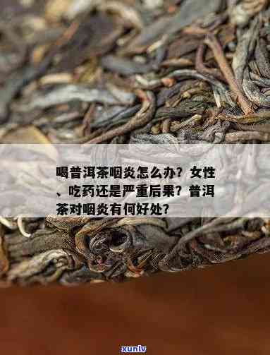 普洱茶能治咽喉炎吗？怎么喝？请提供相关信息。