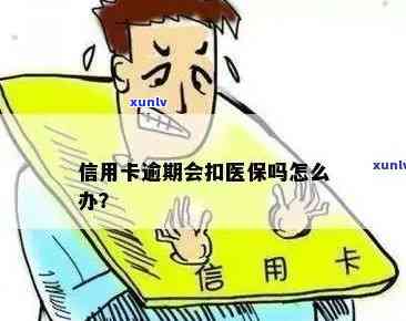 信用卡逾期还款会影响医保吗？如何避免对医保的影响？