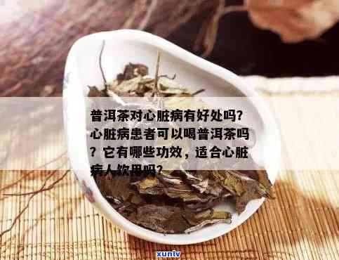 普洱茶：预防与治疗冠心病的心脏病医生推荐的健饮品