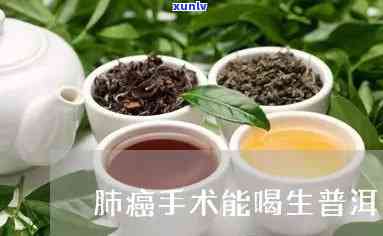 手术后食管癌患者是否可以饮用普洱茶？医生给出专业建议