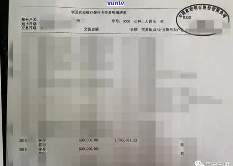 荨麻疹患者：了解茶叶摄入对病情的影响及医生建议