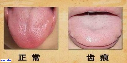 绿茶爱好者必读：齿痕舌如何适应并享受绿茶？