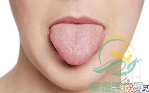 舌苔有齿痕能喝绿茶吗？女性适合喝什么茶？