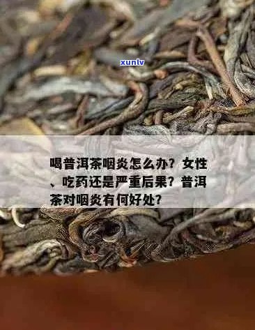 普洱茶能治咽喉炎吗