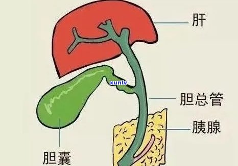 喝普洱茶犯胆囊炎吗怎么回事？普洱茶对胆囊炎的影响如何？