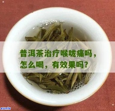 喝普洱茶后的喉咙痛怎么办？解决 *** 和推荐