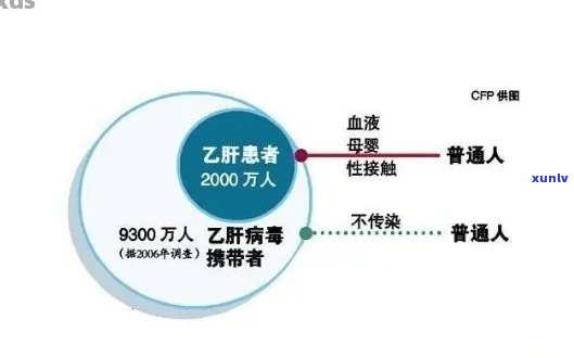 乙肝病人可以喝普洱茶吗？乙肝病携带者和慢性乙肝患者可以喝普洱茶吗？