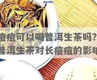 普洱茶对痤疮患者的影响：是否能帮助治疗长痘痘？