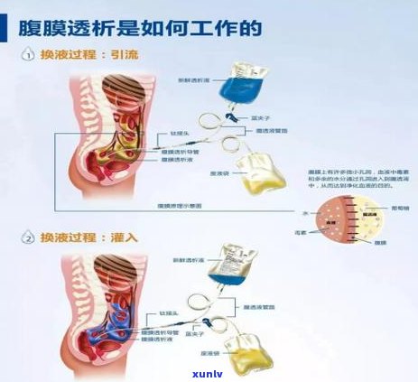 云南普洱茶的优点和好处是什么？