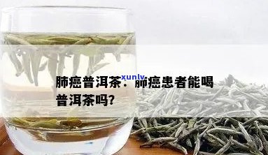 普洱茶与肺结节：患者饮茶是否会加重病情？