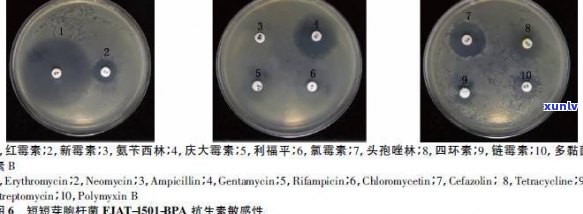 普洱茶中的抗缺氧内生菌：一种新的健益处探索