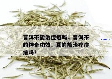 普洱茶对青春痘的作用与适用人群分析：如何利用普洱茶治疗青春痘？