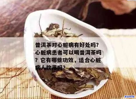 普洱茶与冠心病：患者能否饮用？饮用的注意事项及对健的影响