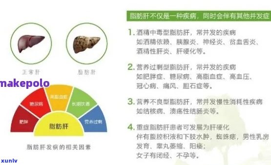 普洱茶：脂肪肝的救星？科学研究解析其功效与潜力