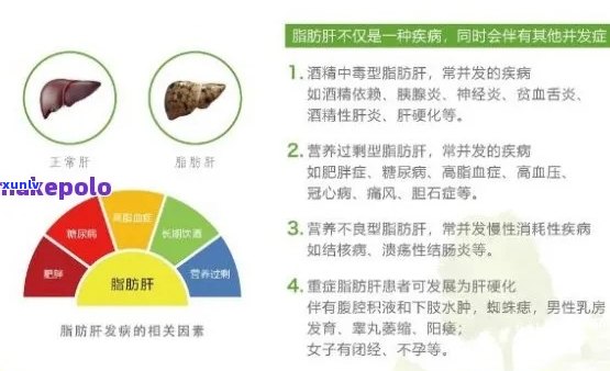 新普洱茶：脂肪肝的？科学研究解析其对脂肪肝的影响。