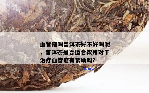 旁腺瘤能否饮用普洱茶？请专家解答